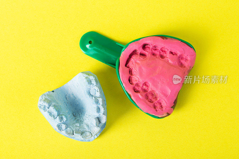带海藻酸盐塑料块的牙科勺子，用于在黄色背景上拍摄牙颌的印象。黄色背景上的蓝色石膏牙颚。牙科正畸学，假牙和牙冠的制造。