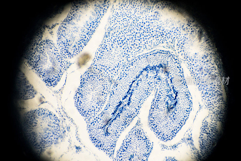 显微镜下睾丸活检图