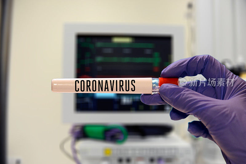 医生在医院拿着冠状病毒试管