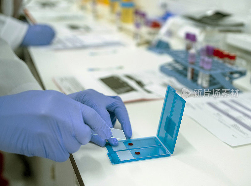实验室技术员在玻片上为化验准备血液涂片的手特写