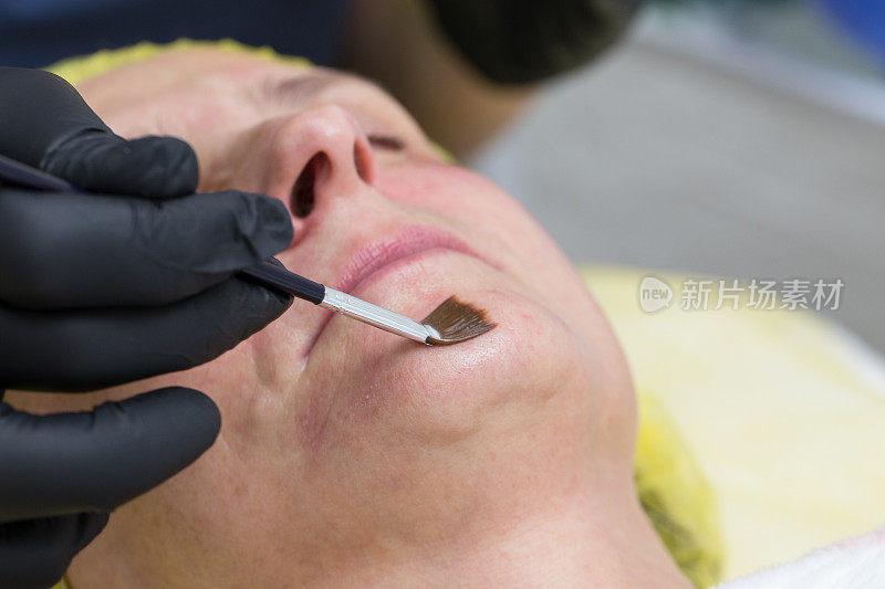 美容师将一种透明的化学溶液用于女性面部脱皮。