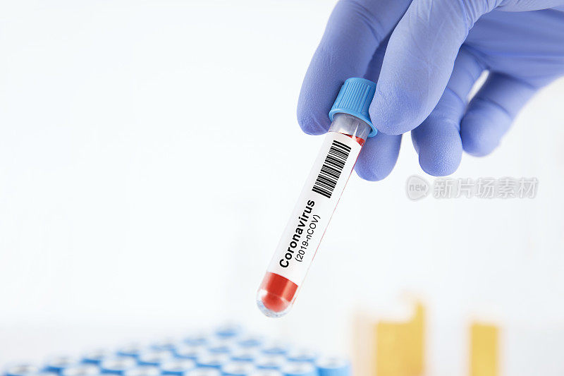 冠状病毒血液测试