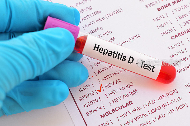 D型肝炎病毒(HDV)试验