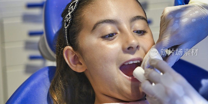 牙科检查。年轻女孩正在牙科诊所洗牙