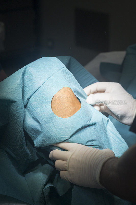 为手术做膝盖准备医院手术急诊室手术室的医疗程序。