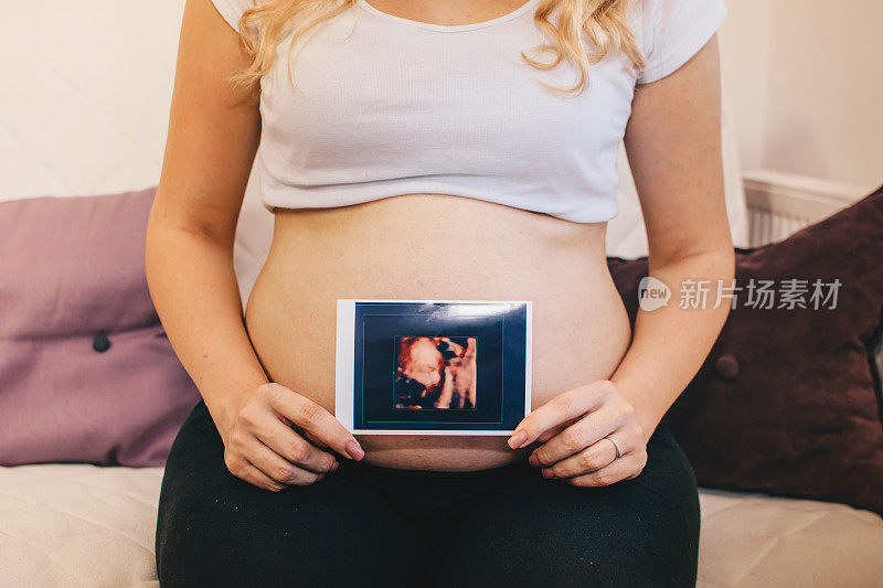 孕妇看她的宝宝的3D超声波照片