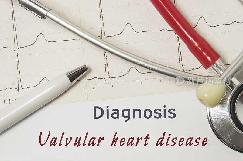 心脏瓣膜病的心脏诊断。在医生的工作场所是纸质医疗文件，表明诊断瓣膜性心脏病，包围红色听诊器，心电图线近距离