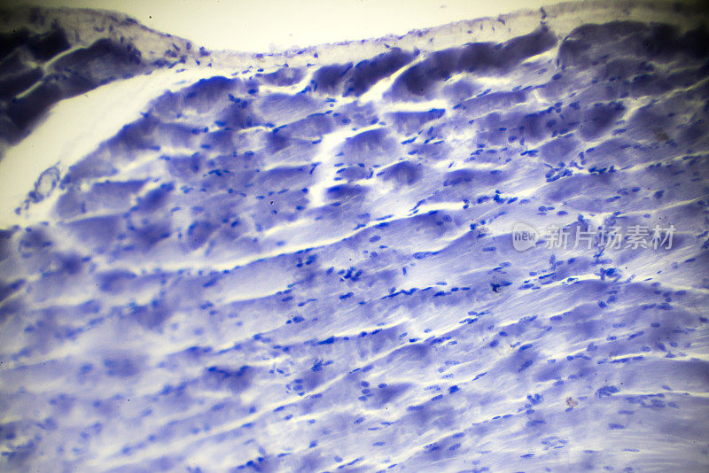 显微镜下骨骼肌纵切面