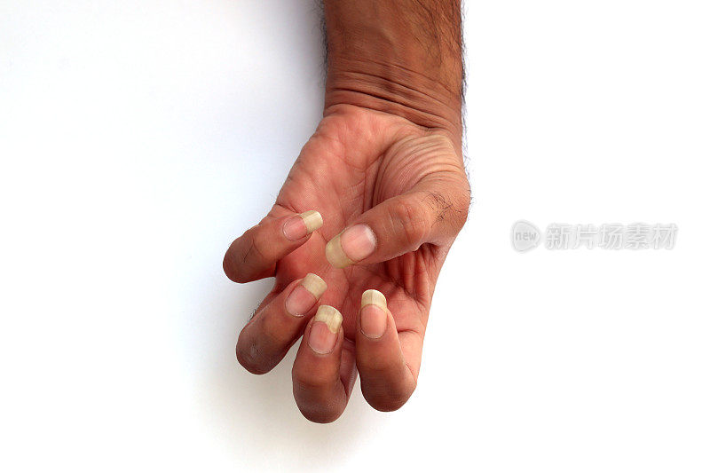 人的手指甲被隔离在白色背景上