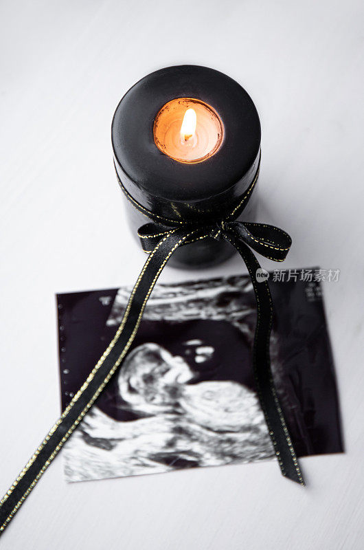 丧、流产、流产或哀伤辅导的概念形象。婴儿的超声波照片，旁边是黑色蜡烛和黑色丝带燃烧。