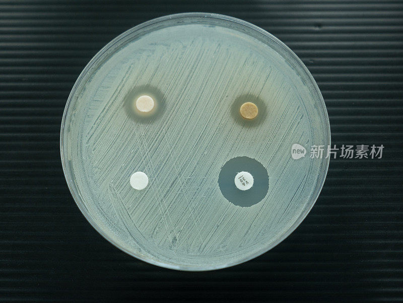 在实验室检查抗生素的培养皿的特写镜头。