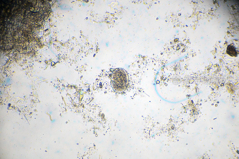 日本血吸虫虫卵光镜下观察
