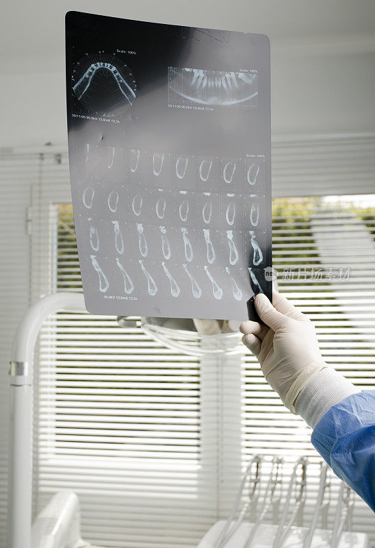 牙科医生，口腔x光检查(口腔x光)，牙科诊所背景