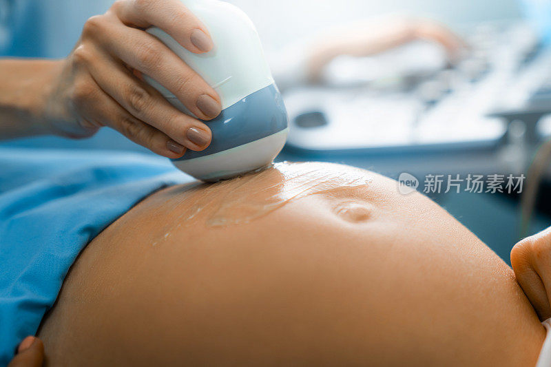 医生通过移动腹部传感器对孕妇进行超声波扫描的特写镜头。孕期超声检查。