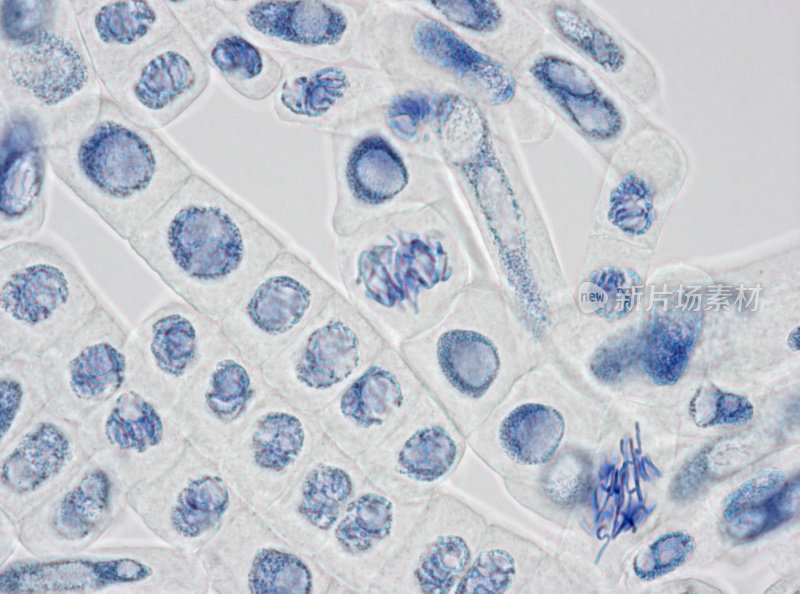 植物细胞细胞核和染色体染色的显微镜图像