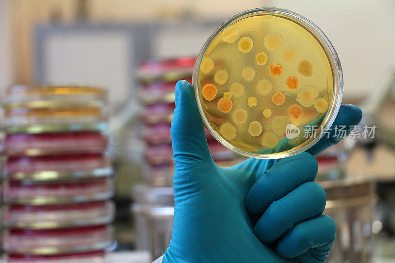 微生物学家拿着一个覆盖着菌落的琼脂培养皿