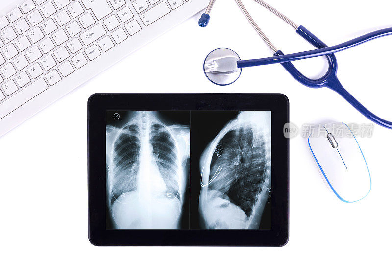 远程医疗:带听诊器和胸部x光片的数字平板