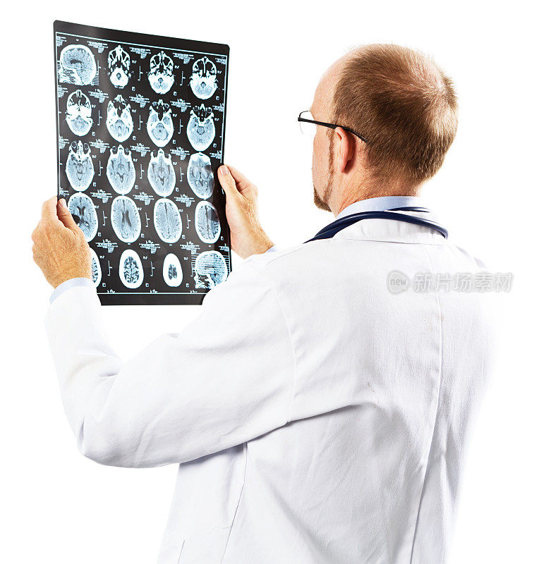 医生检查大脑MRI图像的回顾