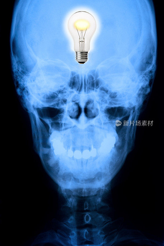 带照明灯泡的颅骨正面x光片