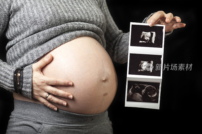 孕妇拿着超声波图像