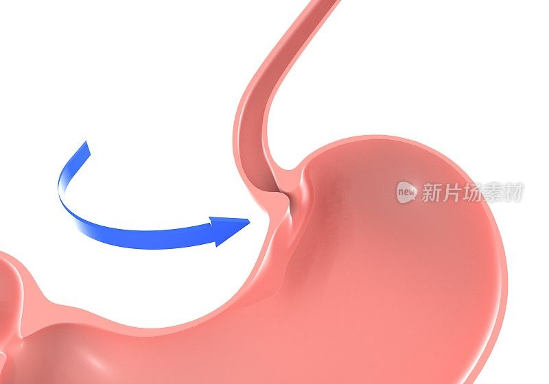 人体胃的3D插图，突出十二指肠括约肌和食道。