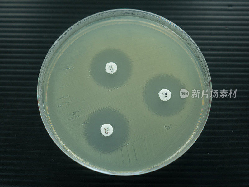 在实验室检查抗生素的培养皿的特写镜头。