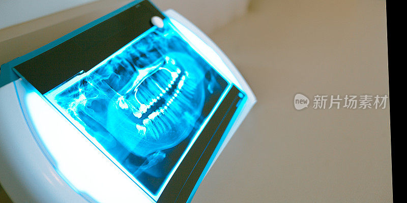 牙科诊所的牙齿x光特写