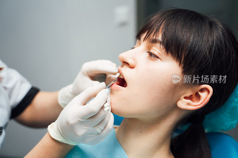 牙科诊所。接待、检查病人。牙齿保健。年轻女子接受牙科医生的牙齿检查