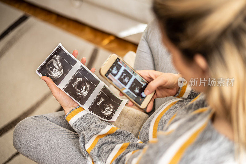 一名孕妇正在做超声波扫描