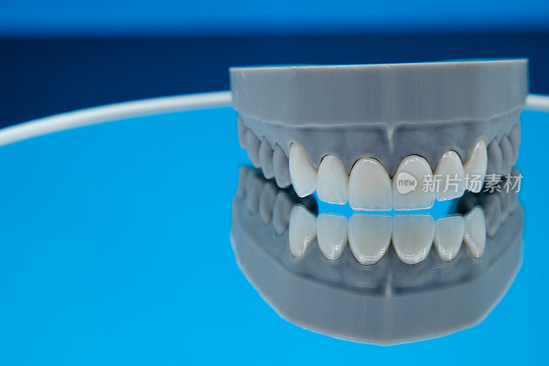 为高档牙科诊所制作的贴面牙模型