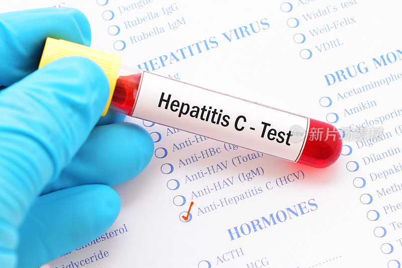 丙型肝炎测试