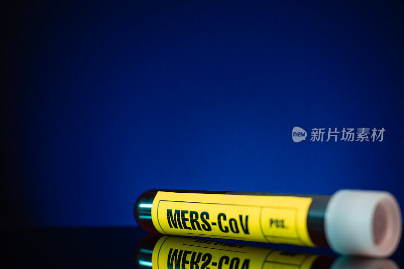 MERS-CoV病毒血样检测管特写黄色标记，蓝色背景