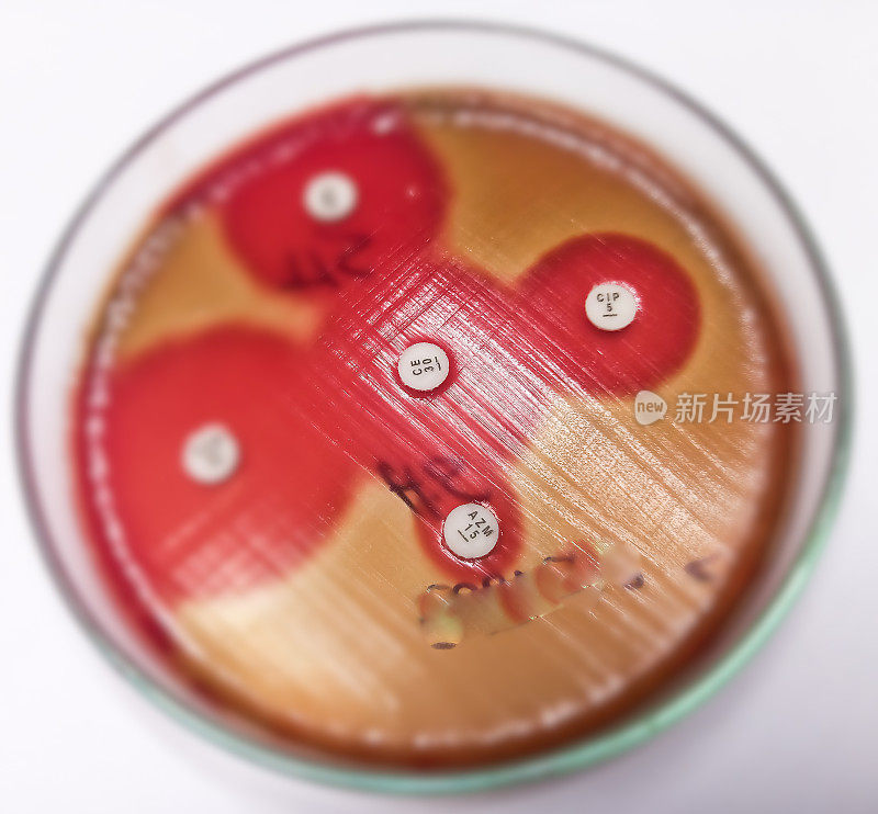 抗生素耐药性和敏感性测试。选择性聚焦头孢氨苄(CE)、阿奇霉素(AZM)、环丙沙星(CIP)抗生素对菌落的影响。这种细菌耐阿奇霉素。