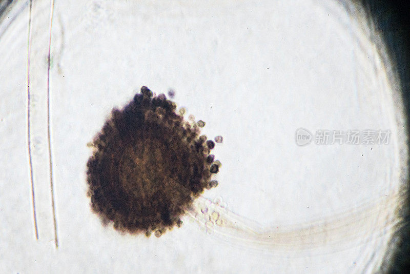 曲霉属真菌在显微镜下