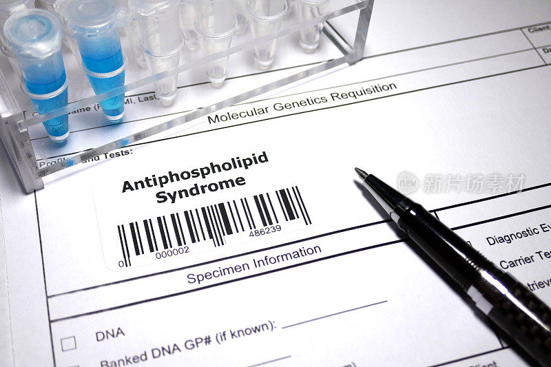 Antiphospholipid综合症