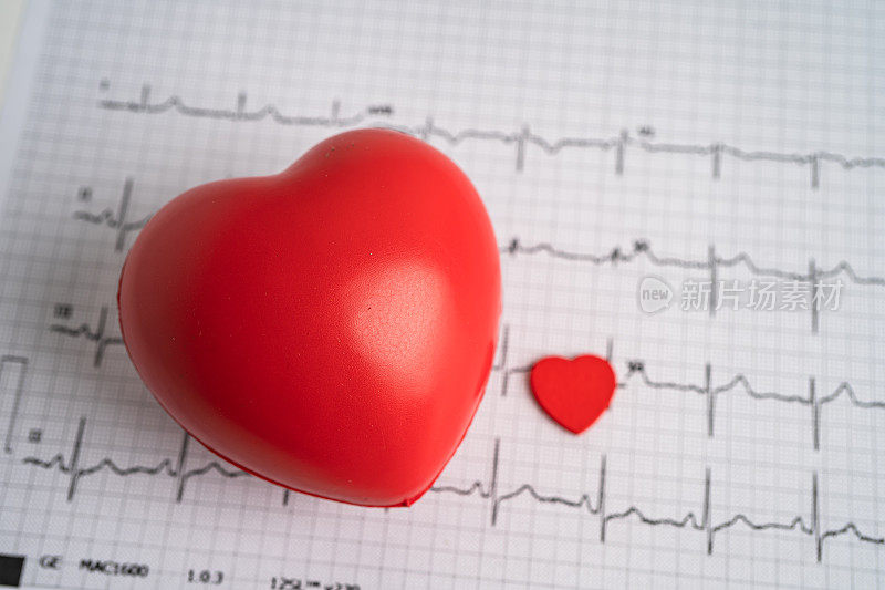 心电图上有红心，心悸，心脏病发作，心电图报告。
