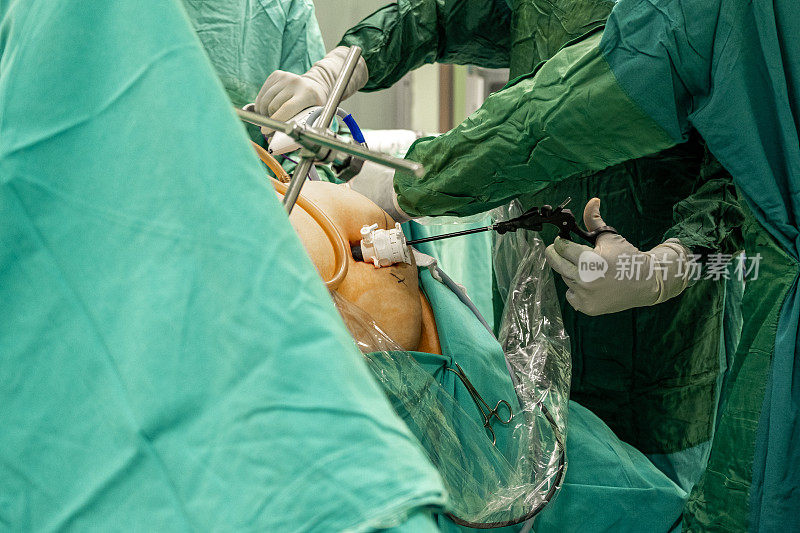 胃袖手术图像，病人腹部特写，手术手和机器人系统