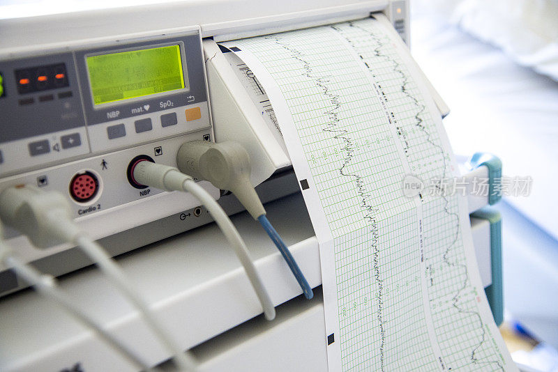 Cardiotocography(玻纤)