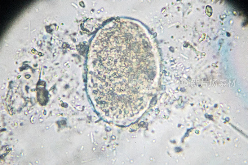 日本血吸虫虫卵光镜下观察