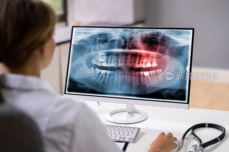 放射科牙医使用X光软件