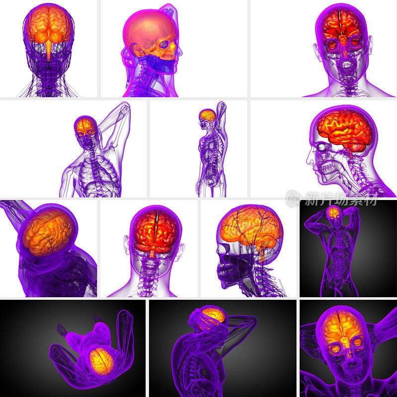 3d渲染的医学插图的大脑