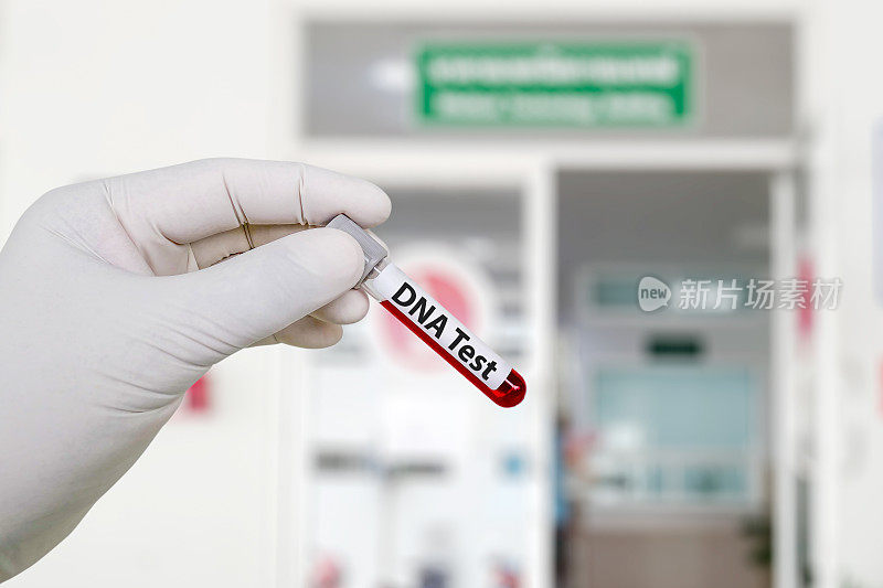 DNA测试。医生拿着血样采集管在实验室前做DNA检测。