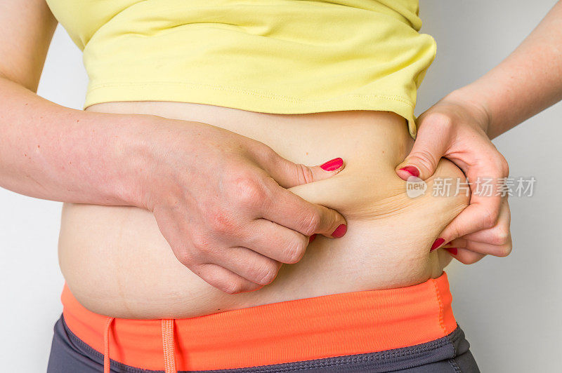 女性身体超重与臀部脂肪-肥胖概念