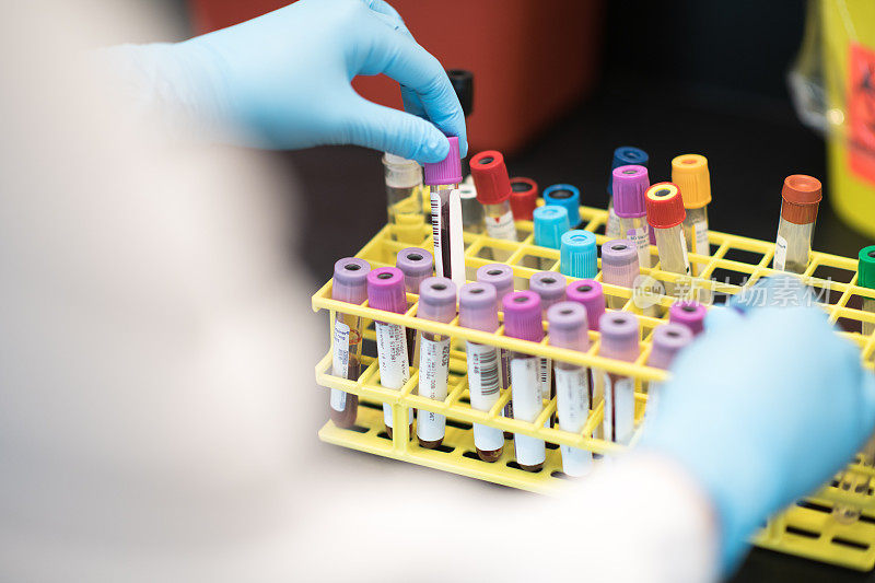 血液瓶被放置在机架库存照片