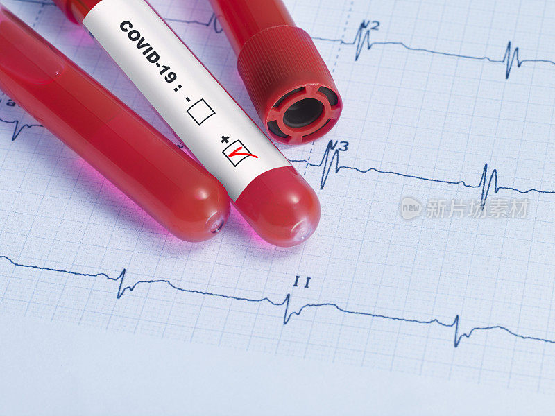 真实心电图和Covid-19血液试管