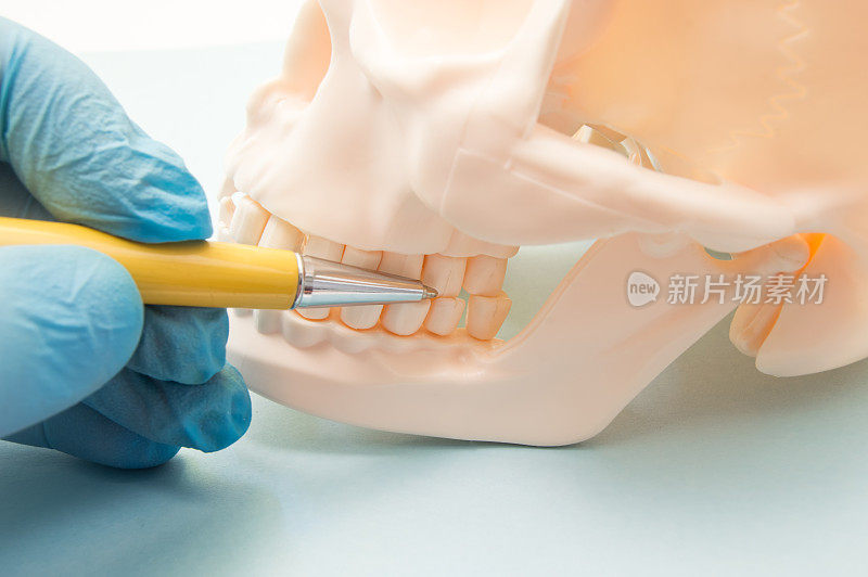 人类颅骨解剖模型上上下颌的磨牙。牙科医生向病人展示需要在诊所诊断和治疗的磨牙
