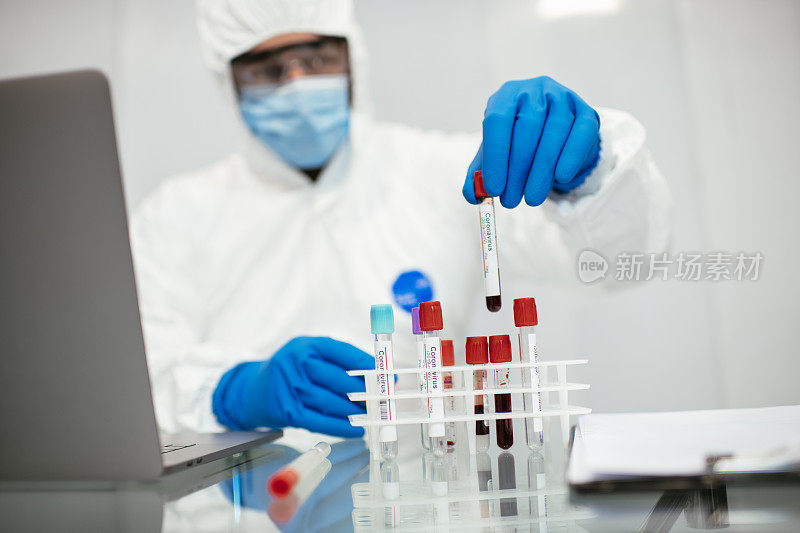 血液检测库存照片