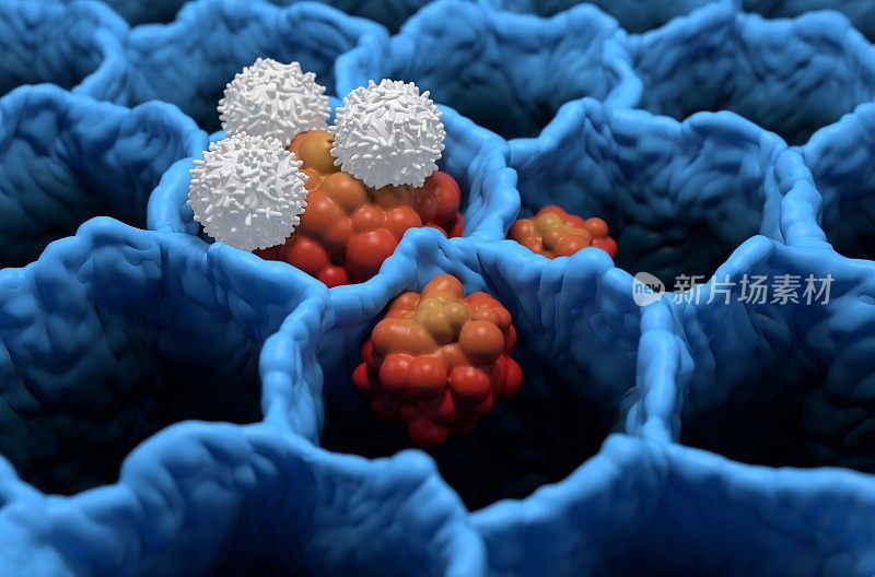t细胞攻击小细胞肺癌肿瘤微生物三维图解等距视图