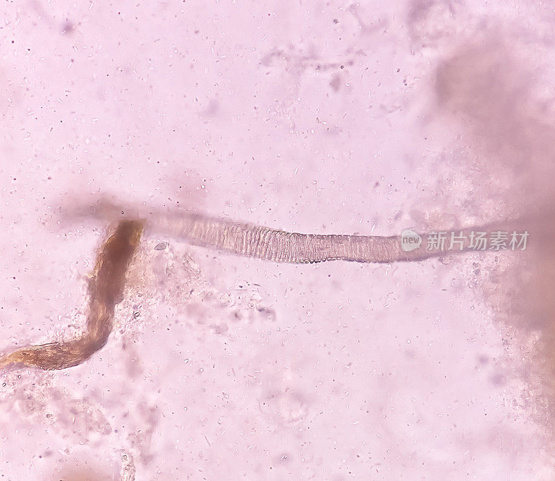肠道蠕虫粪便检查，40倍光镜下，选择性聚焦。绦虫、钩虫、蛲虫