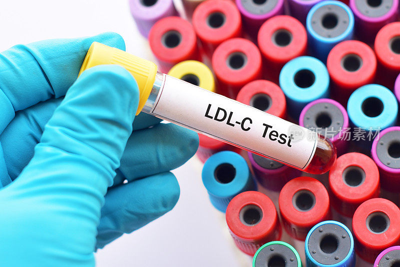 LDL检测血样
